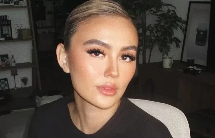 Mengenal Alopecia Areata, Penyakit yang yang dimaksud Menjangkit Agnez Mo hingga Alami Kebotakan